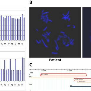 Whole APC Gene Deletion Detected By MLPA And FISH Analysis A