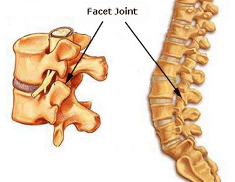 Modern Pain Consultants