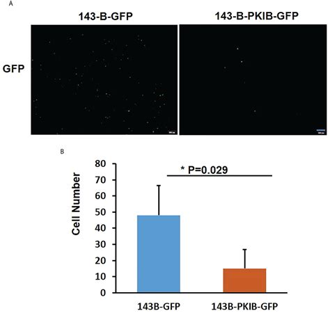 Frontiers Pkib Involved In The Metastasis And Survival Of Osteosarcoma