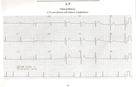 Doctors Network: ECG Interpretations