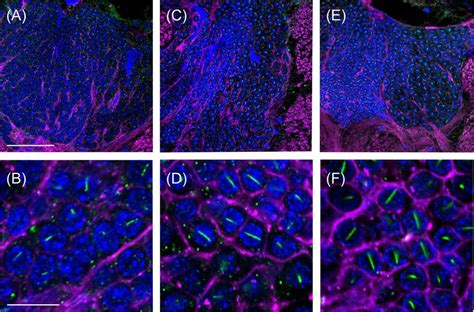 Caste And Sex Specific Differences In Labeling With AmBNSab Staining