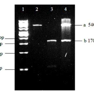 Confirmation of cloning product pET30a DBL2β by digestion using BamH1