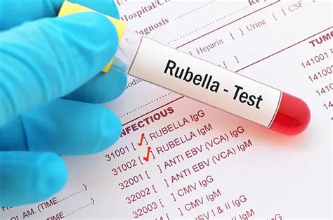 Tes Anti Rubella Igg Tujuan Jenis Dan Prosedur Halodoc