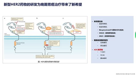 2023年her 2阳性胃癌治疗新突破胃癌靶向药物化疗 健康界