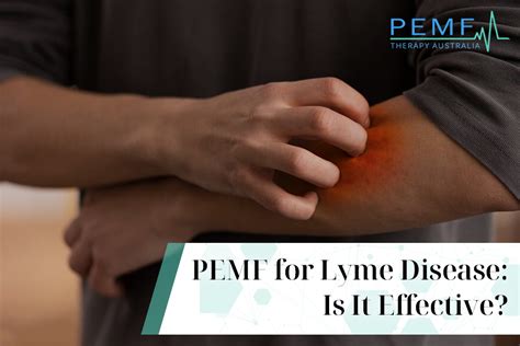 PEMF Therapy For Lyme Disease Efficacy And Insights