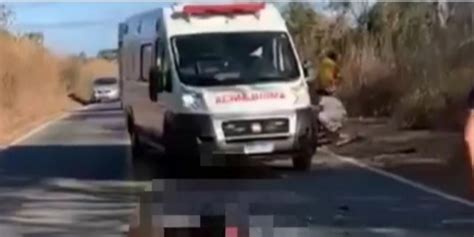 Motociclista Tem Perna Dilacerada Em Acidente Na Tarde De Hoje Na