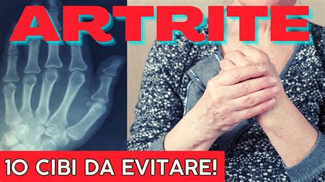 Artrite E Alimentazione I 10 Cibi Da Evitare Artrite Prevenzione