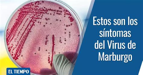 Virus de Marburgo cómo se contagia y qué síntomas tiene esta enfermedad