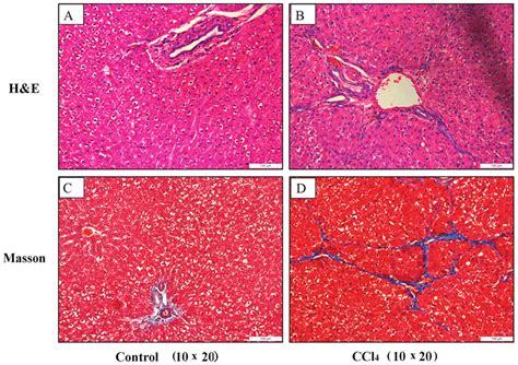 Histological Staining In Liver Tissues Of Untreated And Ccl Treated