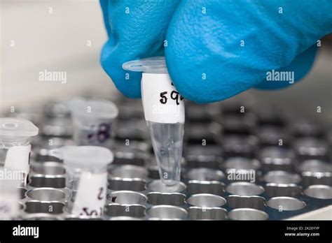 Closeup Of A Scientist Hand While Working At The Laboratory With A