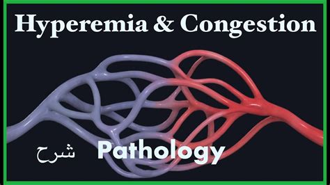 Pathology | Congestion & Hyperemia | (Hemodynamic) blood disorders 3 ...