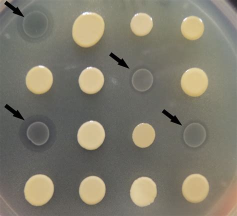 Cell Free Supernatants From Cultures Of Lactic Acid Bacteria Isolated