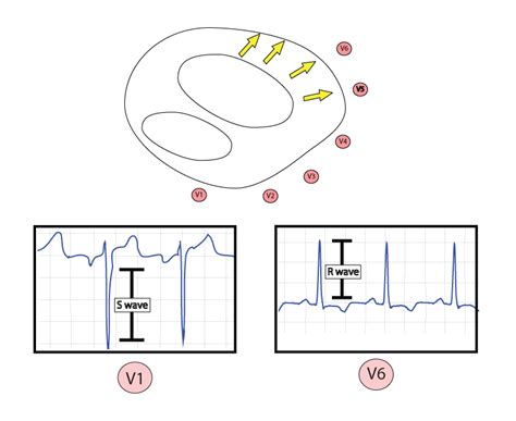 Mcgill Ekg Learning Project