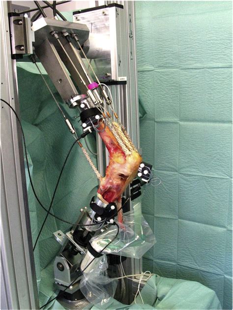 Femorotibial Kinematics And Load Patterns After Total Knee Arthroplasty