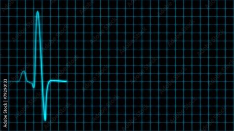 Cardiogram Cardiograph Oscilloscope Screen With Grid Blue Loop Stock