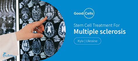 Stem Cell Therapy For Multiple Sclerosis Treatment In Europe