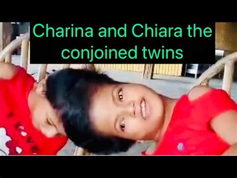 Charina And Chiara The Conjoined Twins Part Youtube