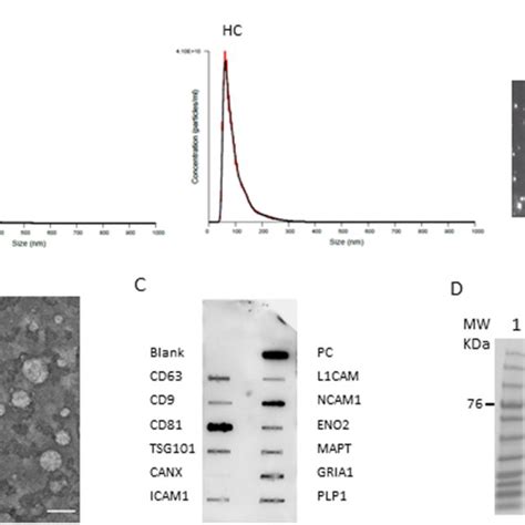 Western Blot Analysis Of Synuclein Aggregation In Ndes Lane