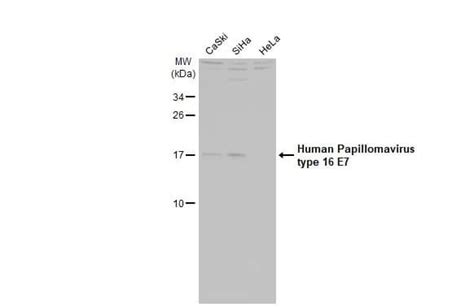 Hpv16 E7 Antibody Hl1821 Azide And Bsa Free Nbp3 25511 Novus