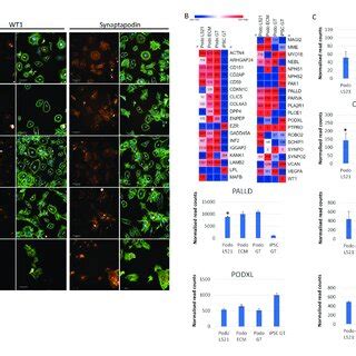 Podocyte-specific markers upon iPSC differentiation into podocyte-like... | Download Scientific ...