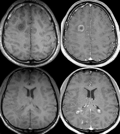 Daniel Gewolb Md On Twitter Interesting Case What Is The Most