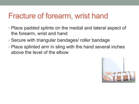 Splinting in first aid