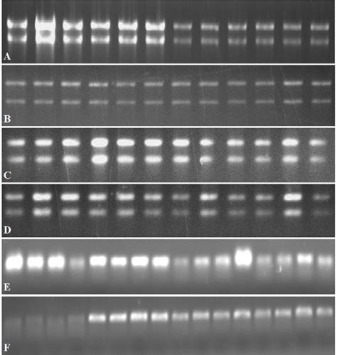 total rna extracted  methods  rna isolation kit   kit
