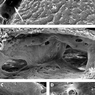 (PDF) Architecture of arachnoid trabeculae, pillars, and septa in the subarachnoid space of the ...