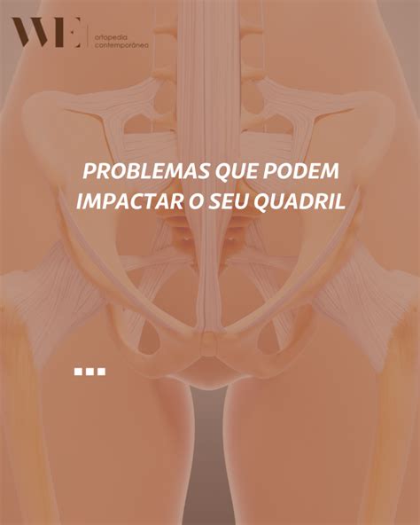 Problemas Que Podem Impactar O Seu Quadril We