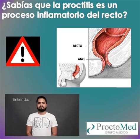 Proctitis Video Medicos Hemorroides Bienestar