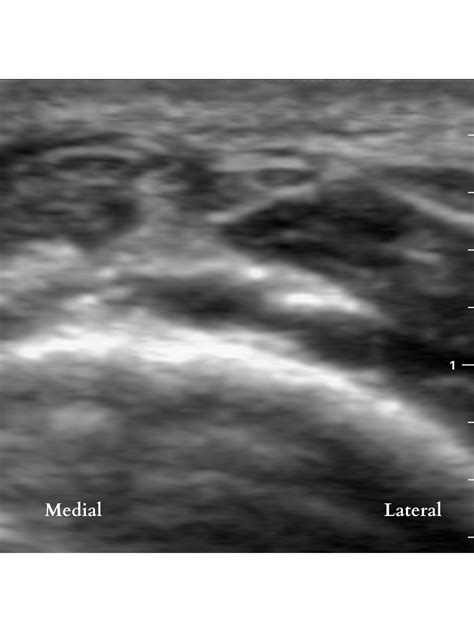 Ankle Block — Baby Blocks