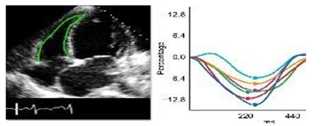 Journal of Cardiology and Cardiovascular Research