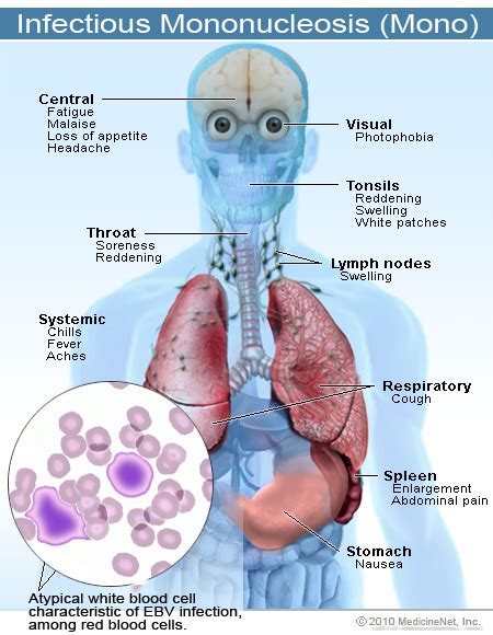 Pathophysiology And Clinical Presentation Correct Diagnosis