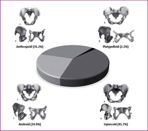 Types Of Pelvis