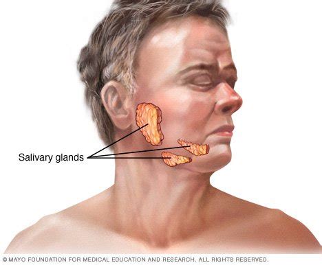 Cancer Symptoms Salivary Gland Cancer Symptoms