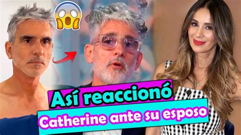 La REACCIÓN de Catherine Siachoque AL REJUVENECIMIENTO FACIAL de su