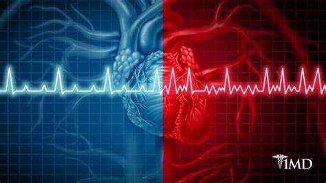 The Best Natural Ways To Treat Atrial Fibrillation Quick How To Guide