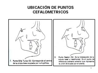 Puntos Cefalometricos Ppt