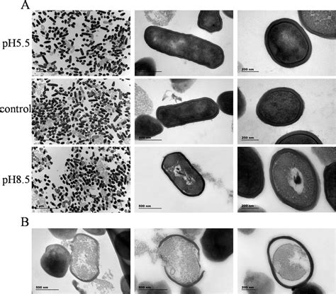 TEM Images Of L Plantarum ATCC 14917 In Acid Control And Alkali