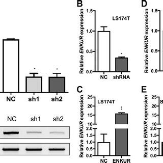 Enkur Associates With Emt In Crc Cells A Silencing Of Enkur Induces