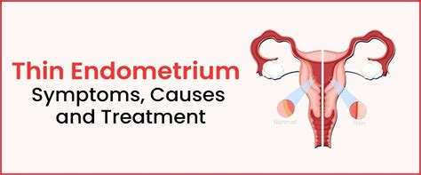 Thin Endometrium Symptoms Causes And Treatment