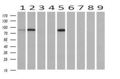 PFKP Antibody OTI1D6 Azide And BSA Free NBP2 73344 By Novus Part