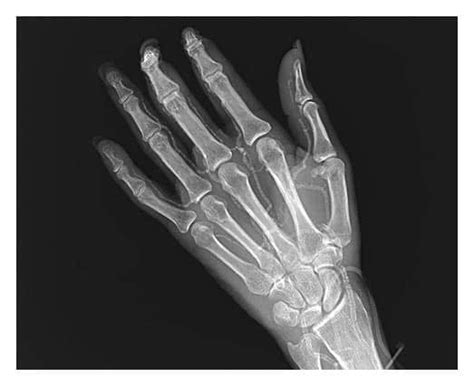 calcification  corollary  human maturity ted seymour