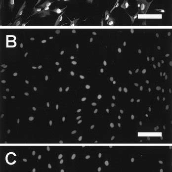 Immunofluorescence Staining Of Cultured Human Keratocytes With