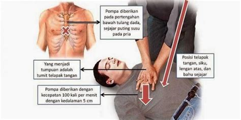 Penting Inilah Langkah Pertolongan Pertama Pada Korban Serangan