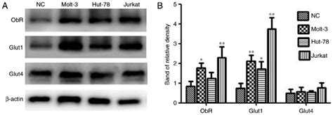 Obr Glut1 And Glut4 Expression In Tcl Cell Lines And Pbmcs A