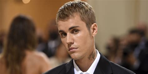 Justin Bieber Cancela Sus Conciertos Por Una Par Lisis Facial Que Le