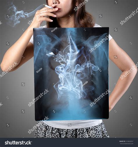 296 Xray Smoker Lungs Images, Stock Photos & Vectors | Shutterstock