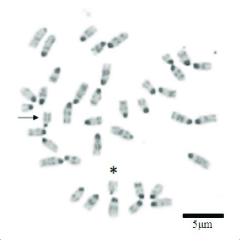 Chromosome plate typical of RI 70. Arrow points to chromosome 18 with ...