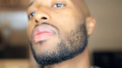 Minoxidil Beard Journey Year 2 Week 15 Youtube